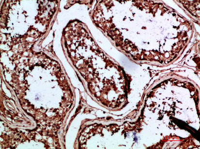 Rabbit Polyclonal Antibody to INSL3