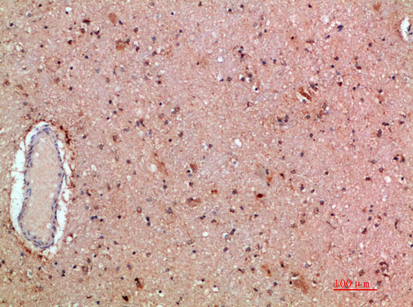 Rabbit Polyclonal Antibody to MLL