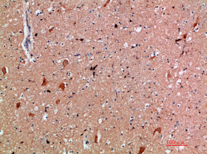 Rabbit Polyclonal Antibody to CD300e