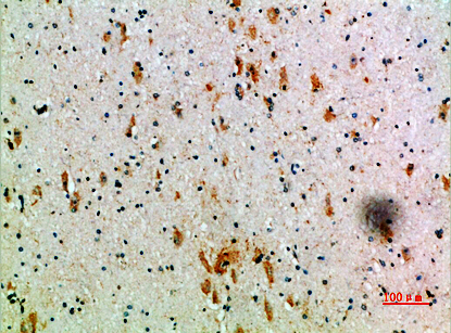 Rabbit Polyclonal Antibody to CD158k