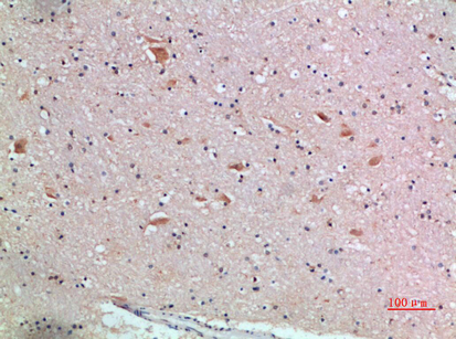 Rabbit Polyclonal Antibody to Frizzled-9