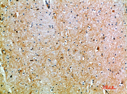 Rabbit Polyclonal Antibody to CD231