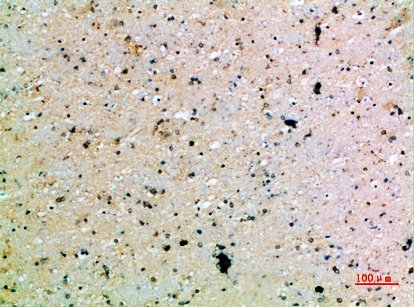 Rabbit Polyclonal Antibody to PDGF-C