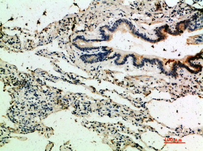 Rabbit Polyclonal Antibody to Thrombospondin 4