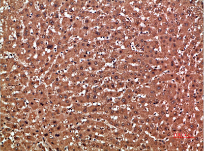 Rabbit Polyclonal Antibody to GSTA1