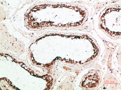 Rabbit Polyclonal Antibody to PACAP