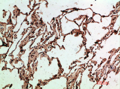 Rabbit Polyclonal Antibody to ADI1