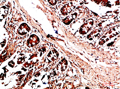 Rabbit Polyclonal Antibody to HLA-DQA1