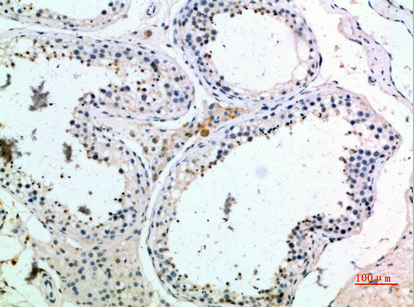 Rabbit Polyclonal Antibody to PMCH
