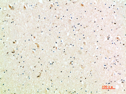 Rabbit Polyclonal Antibody to MIG