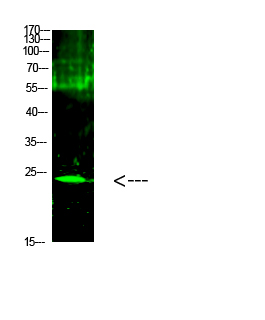 Rabbit Polyclonal Antibody to Cardiotrophin-1