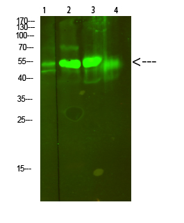 Rabbit Polyclonal Antibody to V-ATPase S1