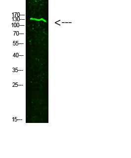 Rabbit Polyclonal Antibody to COL19A1