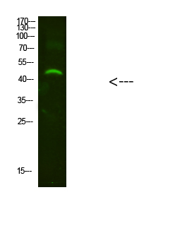 Rabbit Polyclonal Antibody to NMUR2