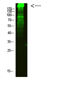 Rabbit Polyclonal Antibody to MYH6