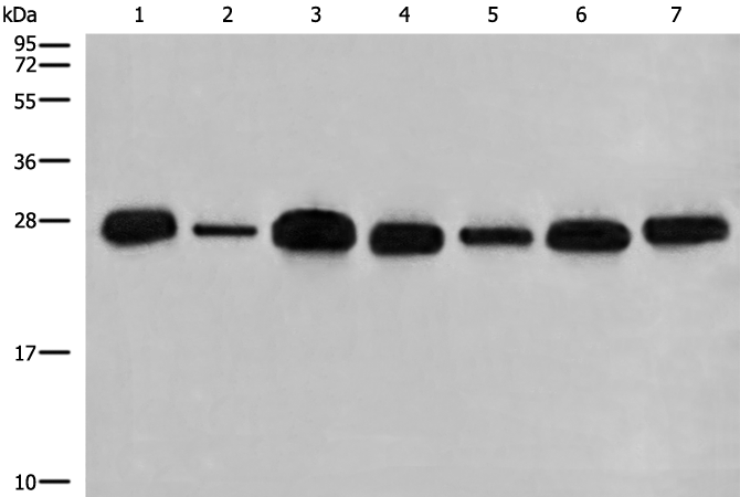 Rabbit Polyclonal Antibody to C21orf33