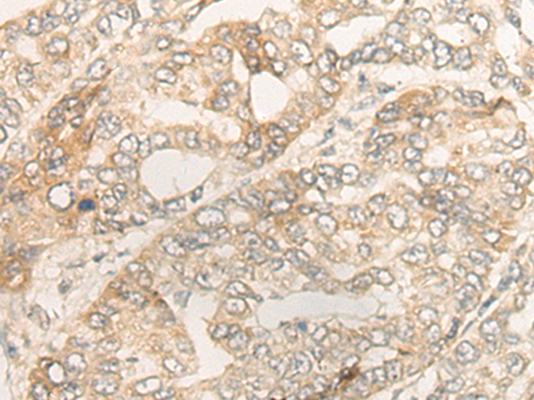 Rabbit Polyclonal Antibody to DUOX2