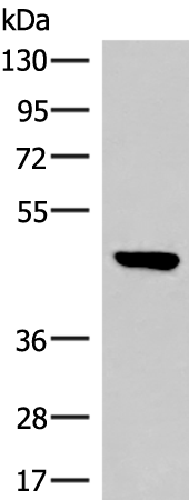 Rabbit Polyclonal Antibody to ASB6