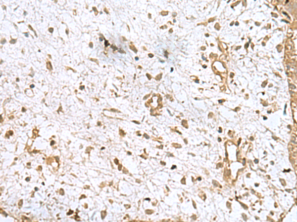 Rabbit Polyclonal Antibody to AK6