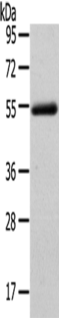 Rabbit Polyclonal Antibody to FOXC1