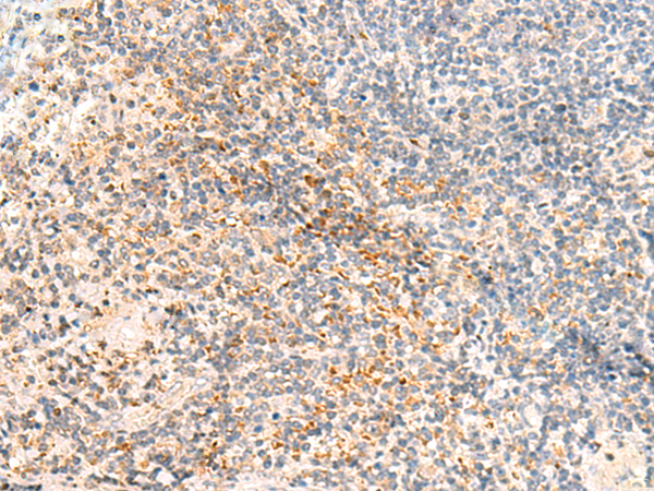 Rabbit Polyclonal Antibody to CLDN16
