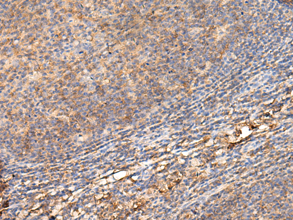 Rabbit Polyclonal Antibody to ADGRA1