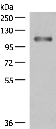 Rabbit Polyclonal Antibody to PHF2