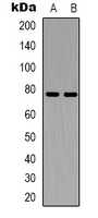 Rabbit Polyclonal Antibody to CEP78