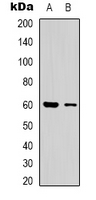 Rabbit Polyclonal Antibody to CLIP3