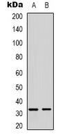 Rabbit Polyclonal Antibody to FOXE3
