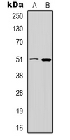 Rabbit Polyclonal Antibody to GABRD