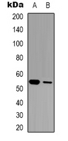 Rabbit Polyclonal Antibody to GABRG1