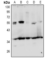 Rabbit Polyclonal Antibody to GRTP1