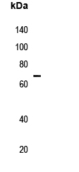 Rabbit Polyclonal Antibody to KLHL3
