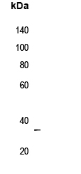 Rabbit Polyclonal Antibody to MAGEA5