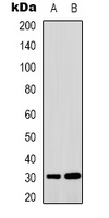 Rabbit Polyclonal Antibody to MTIF3