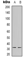 Rabbit Polyclonal Antibody to NFYB