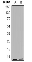 Rabbit Polyclonal Antibody to PP15