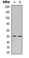 Rabbit Polyclonal Antibody to PLA1A