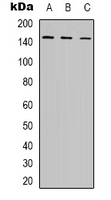 Rabbit Polyclonal Antibody to POLR3A