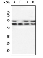 Rabbit Polyclonal Antibody to POTEG