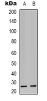 Rabbit Polyclonal Antibody to SCN4B
