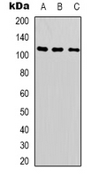 Rabbit Polyclonal Antibody to SUPT16H