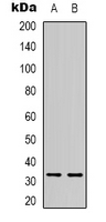Rabbit Polyclonal Antibody to TEF