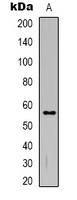 Rabbit Polyclonal Antibody to TMEM145