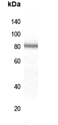 Rabbit Polyclonal Antibody to ZNF225