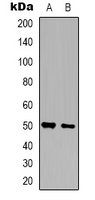 Rabbit Polyclonal Antibody to ZNF436