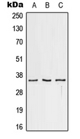 Rabbit Polyclonal Antibody to CD32c