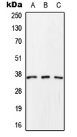 Rabbit Polyclonal Antibody to SCAMP1