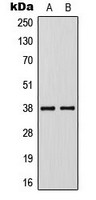 Rabbit Polyclonal Antibody to KLF1/5/7